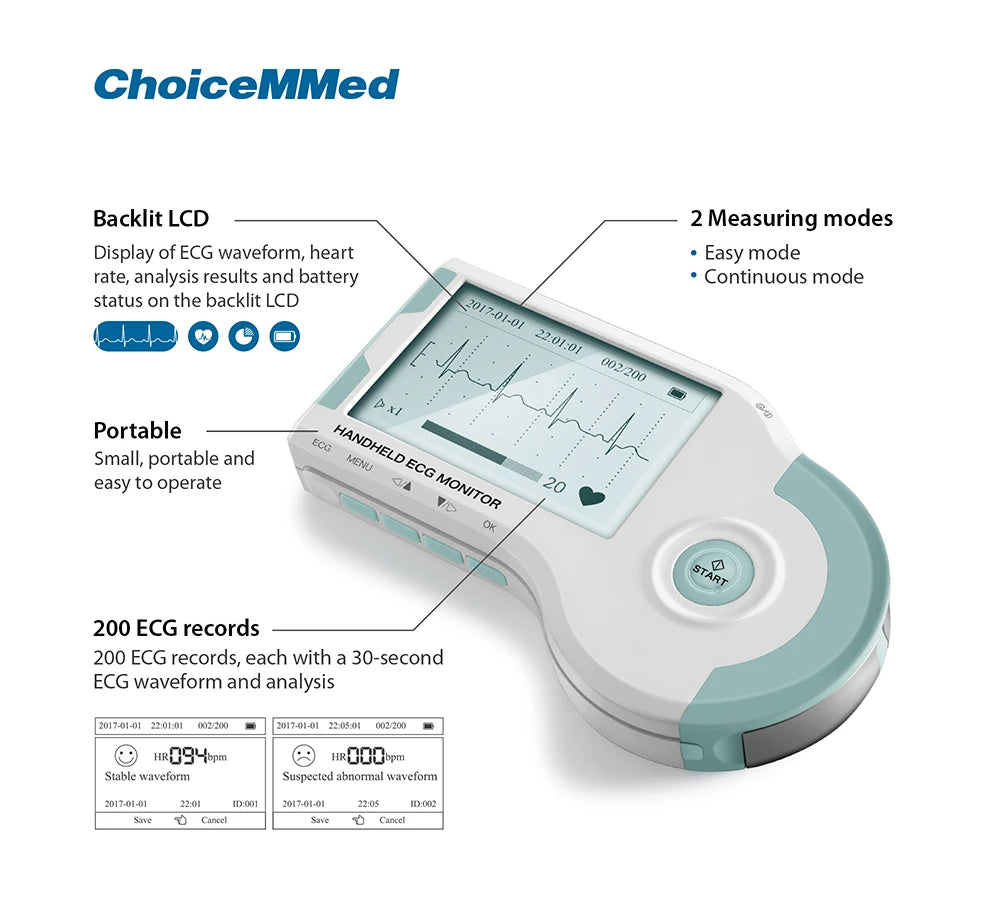 ChoiceMMed Handheld ECG Monitor Real Time Heart Rate Monitoring Electrocardiogram