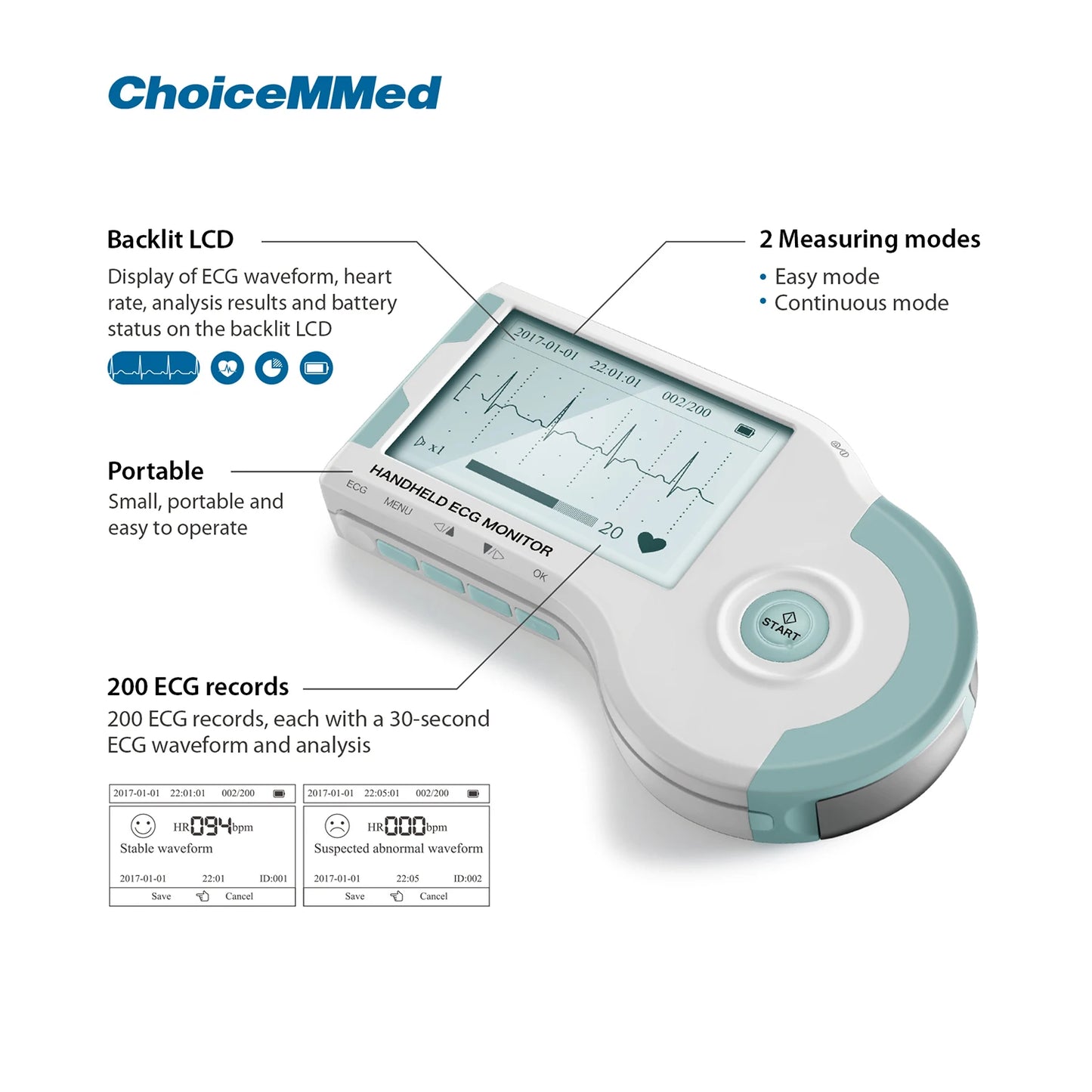 ChoiceMMed Handheld ECG Monitor Real Time Heart Rate Monitoring Electrocardiogram