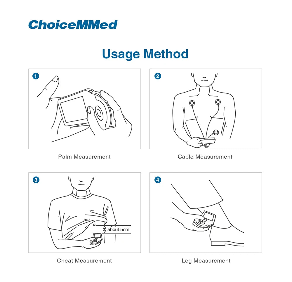 ChoiceMMed Handheld ECG Monitor Real Time Heart Rate Monitoring Electrocardiogram
